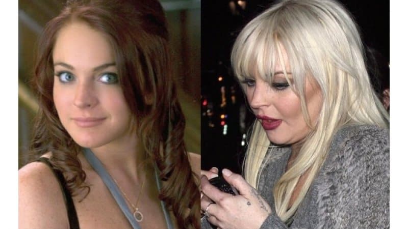 20-worst-cases-of-celebrity-plastic-surgery-gone-wrong-12.jpg