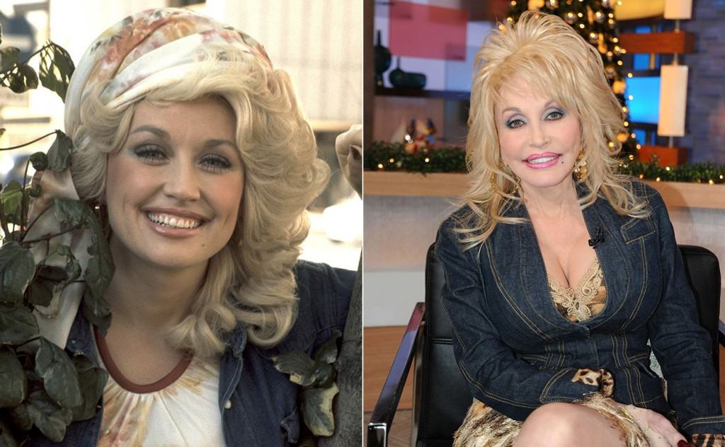 20-worst-cases-of-celebrity-plastic-surgery-gone-wrong-16.jpg