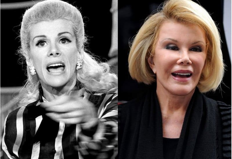 20-worst-cases-of-celebrity-plastic-surgery-gone-wrong-17.jpg