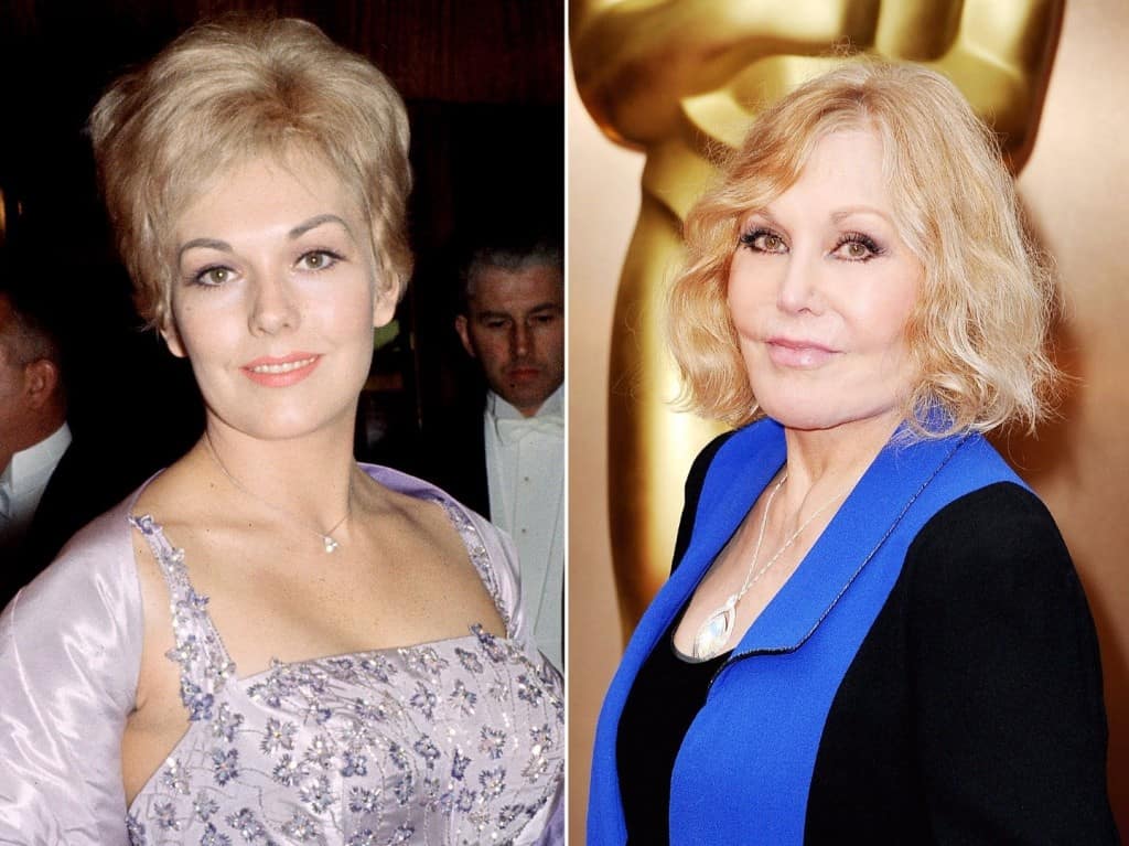 20-worst-cases-of-celebrity-plastic-surgery-gone-wrong-19.jpg