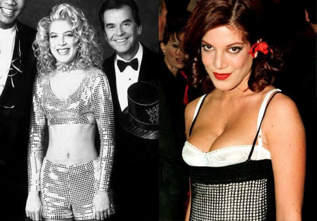 20-worst-cases-of-celebrity-plastic-surgery-gone-wrong-6.jpg