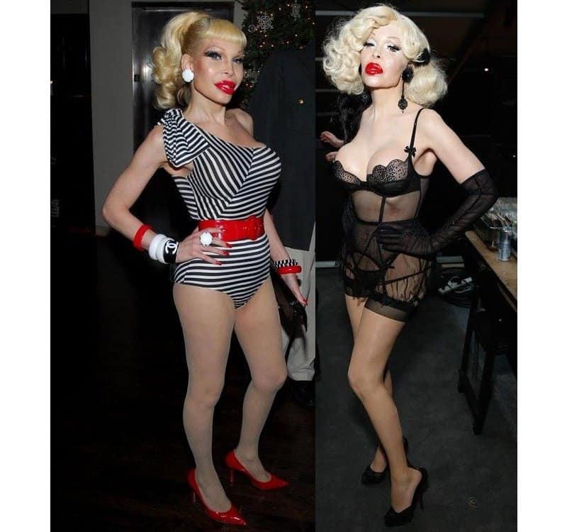 20-worst-cases-of-celebrity-plastic-surgery-gone-wrong-8.jpg