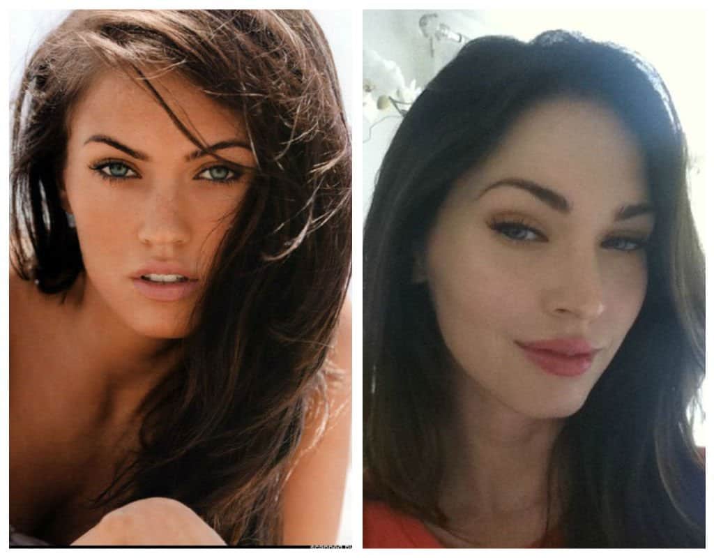 20-worst-cases-of-celebrity-plastic-surgery-gone-wrong-13.jpg