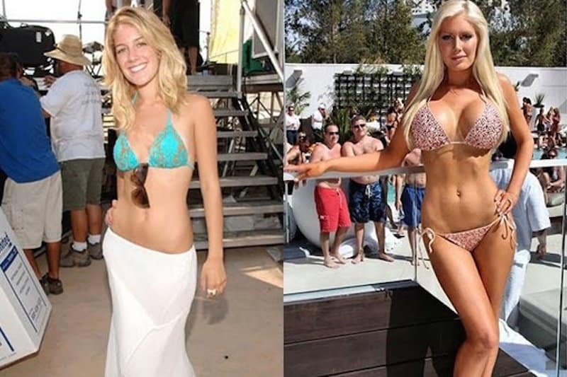 20-celebrities-who-have-undergone-plastic-surgery-2.jpg