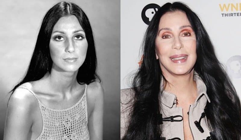 20-celebrities-who-have-undergone-plastic-surgery-9.jpg