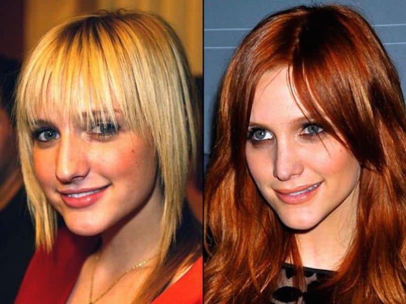 20-celebrities-who-have-undergone-plastic-surgery-15.jpg